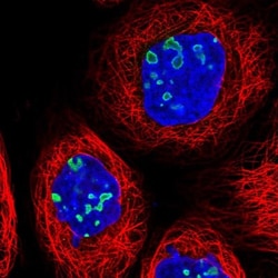 RSL1D1 Antibody, Novus Biologicals 25 &mu;L, Unlabeled:Antibodies, Polyclonal